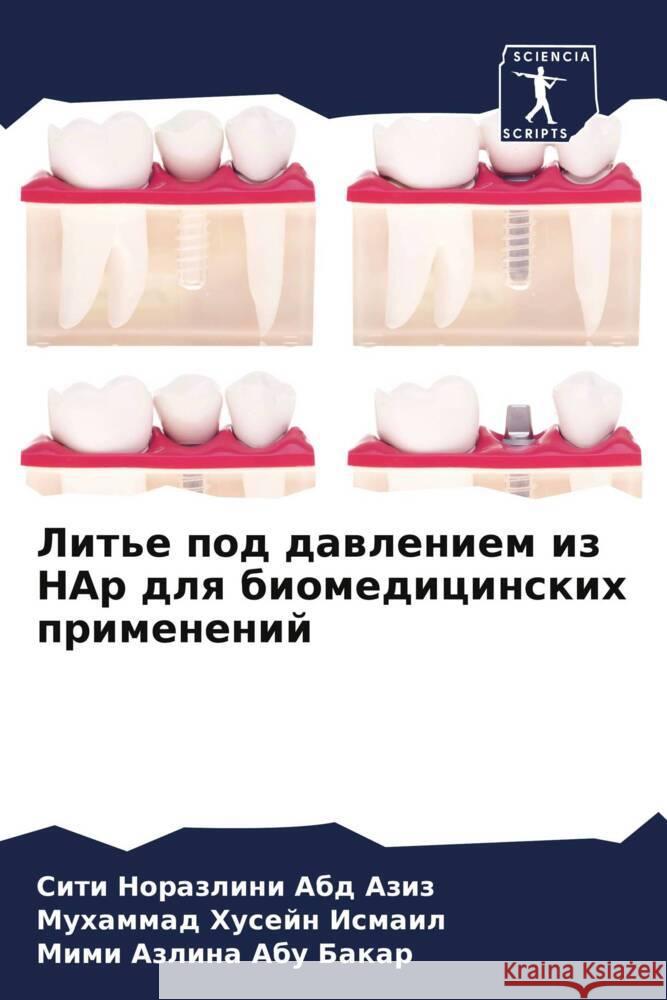 Lit'e pod dawleniem iz HAp dlq biomedicinskih primenenij Abd Aziz, Siti Norazlini, Ismail, Muhammad Husejn, Abu Bakar, Mimi Azlina 9786200117014 Sciencia Scripts