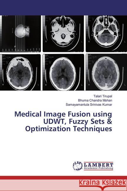 Medical Image Fusion using UDWT, Fuzzy Sets & Optimization Techniques Tirupal, Talari; Chandra Mohan, Bhuma; Srinivas Kumar, Samayamantula 9786200226822