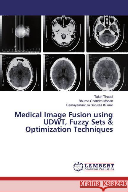 Medical Image Fusion using UDWT, Fuzzy Sets & Optimization Techniques Tirupal, Talari; Chandra Mohan, Bhuma; Srinivas Kumar, Samayamantula 9786200226822