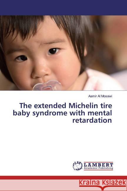 The extended Michelin tire baby syndrome with mental retardation Al Mosawi, Aamir 9786200230638 LAP Lambert Academic Publishing