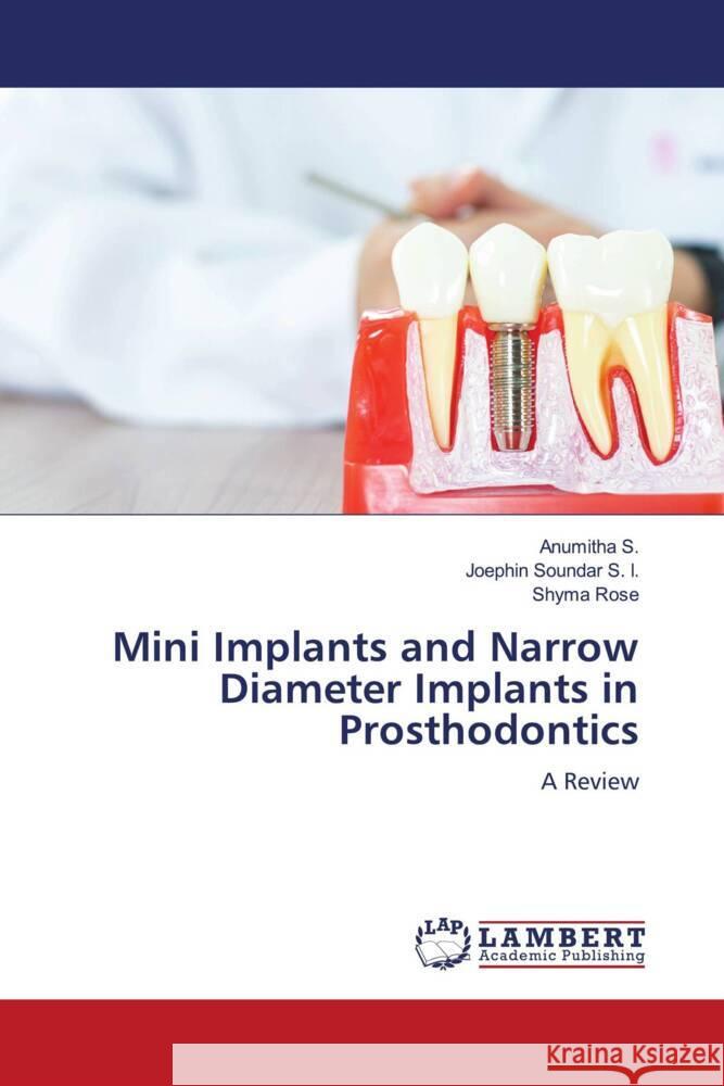 Mini Implants and Narrow Diameter Implants in Prosthodontics S., Anumitha, S. I., Joephin Soundar, Rose, Shyma 9786200230720