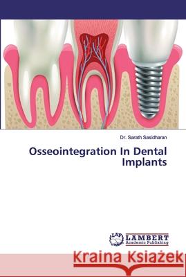 Osseointegration In Dental Implants Sasidharan, Dr. Sarath 9786200240668