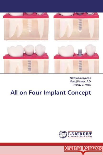 All on Four Implant Concept Narayanan, Nikhita; Kumar. A.D, Manoj; Mody, Pranav V. 9786200244406