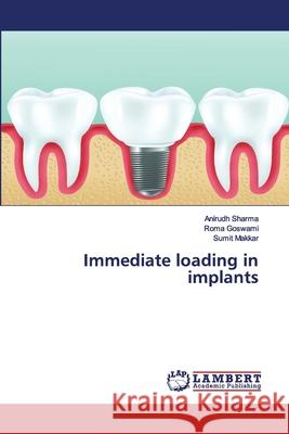 Immediate loading in implants Sharma, Anirudh; Goswami, Roma; Makkar, Sumit 9786200249050