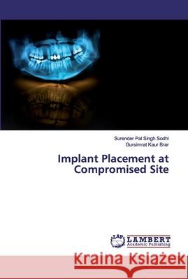 Implant Placement at Compromised Site Sodhi, Surender Pal Singh; Brar, Gursimrat Kaur 9786200256393 LAP Lambert Academic Publishing