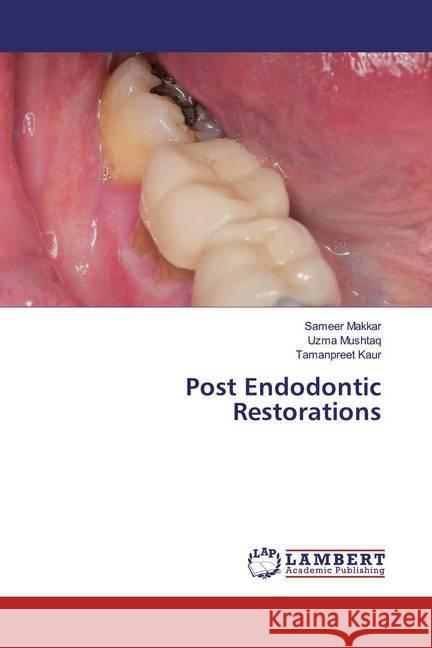 Post Endodontic Restorations Makkar, Sameer; Mushtaq, Uzma; Kaur, Tamanpreet 9786200268303 LAP Lambert Academic Publishing