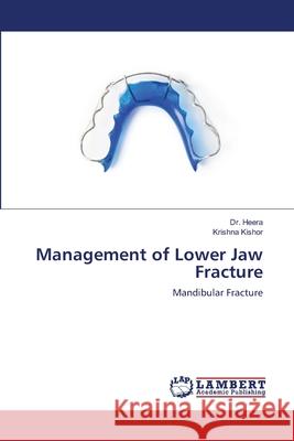 Management of Lower Jaw Fracture Dr Heera, Krishna Kishor 9786200270238