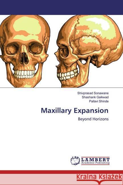 Maxillary Expansion : Beyond Horizons Sonawane, Shivprasad; Gaikwad, Shashank; Shinde, Pallavi 9786200274410 LAP Lambert Academic Publishing