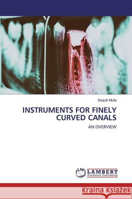 INSTRUMENTS FOR FINELY CURVED CANALS : AN OVERVIEW Mulla, Saquib 9786200297365