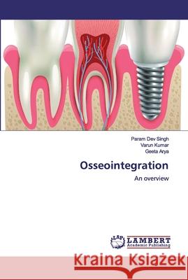 Osseointegration Singh, Param Dev 9786200308344 LAP Lambert Academic Publishing