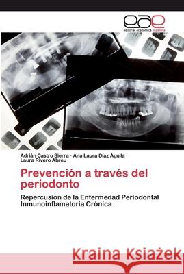 Prevención a través del periodonto Castro Sierra, Adrian 9786200343642 Editorial Académica Española