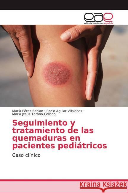 Seguimiento y tratamiento de las quemaduras en pacientes pediátricos : Caso clínico Pérez Fabian, María; Aguiar Villalobos, Rocío; Tarano Collado, María Jesús 9786200374257