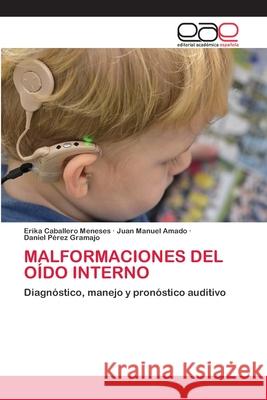Malformaciones del Oído Interno Caballero Meneses, Erika 9786200385475 Editorial Académica Española