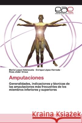 Amputaciones Luque Valenzuela, María 9786200395818