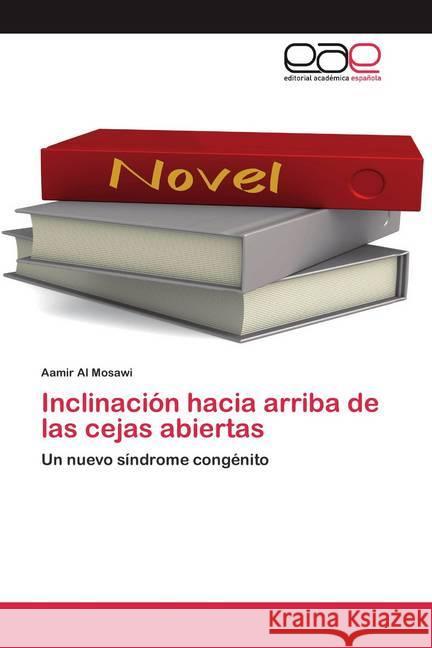 Inclinación hacia arriba de las cejas abiertas : Un nuevo síndrome congénito Al Mosawi, Aamir 9786200399434 Editorial Académica Española