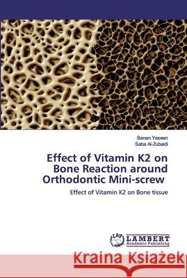Effect of Vitamin K2 on Bone Reaction around Orthodontic Mini-screw Yaseen, Banan 9786200435033 LAP Lambert Academic Publishing