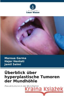 Überblick über hyperplastische Tumoren der Mundhöhle Garma, Maroua, Henteti, Hajer, Selmi, Jamil 9786200449597