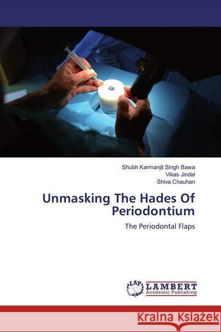 Unmasking The Hades Of Periodontium : The Periodontal Flaps Bawa, Shubh Karmanjit Singh; Jindal, Vikas; Chauhan, Shiva 9786200468680 LAP Lambert Academic Publishing