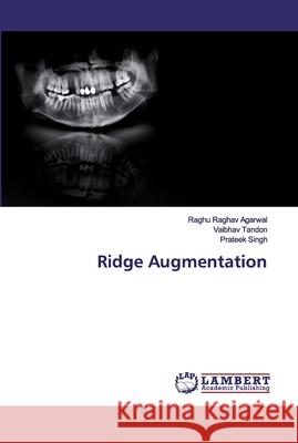 Ridge Augmentation Agarwal, Raghu Raghav; Tandon, Vaibhav; Singh, Prateek 9786200507709 LAP Lambert Academic Publishing