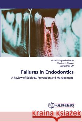 Failures in Endodontics Beble, Gorakh Dnyandev 9786200529862