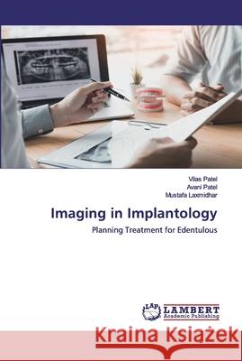 Imaging in Implantology Patel, Vilas 9786200531667