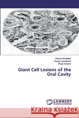 Giant Cell Lesions of the Oral Cavity Kandalkar, Sachin; Tupsakhare, Suyog; Kulkarni, Pooja 9786200534125 LAP Lambert Academic Publishing