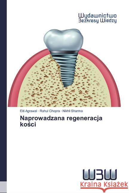 Naprowadzana regeneracja kosci Agrawal, Eiti; Chopra, Rahul; Sharma, Nikhil 9786200546197 Wydawnictwo Bezkresy Wiedzy