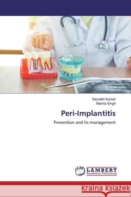 Peri-Implantitis : Prevention and its management KUMAR, SAURABH; Singh, Mamta 9786200550163 LAP Lambert Academic Publishing