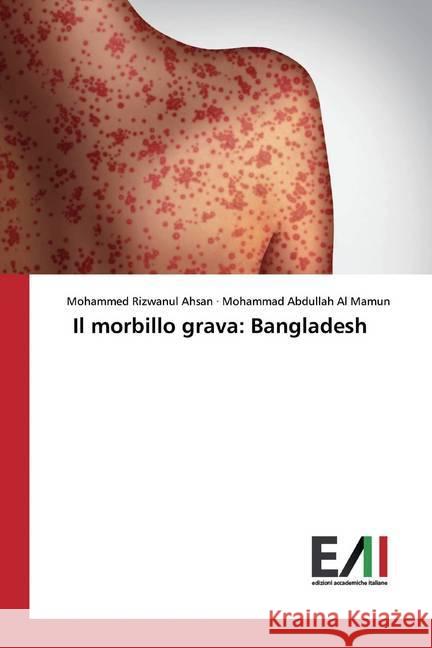 Il morbillo grava: Bangladesh Ahsan, Mohammed Rizwanul; Al Mamun, Mohammad Abdullah 9786200553997