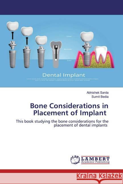 Bone Considerations in Placement of Implant : This book studying the bone considerations for the placement of dental implants Sarda, Abhishek; Bedia, Sumit 9786200586933 LAP Lambert Academic Publishing