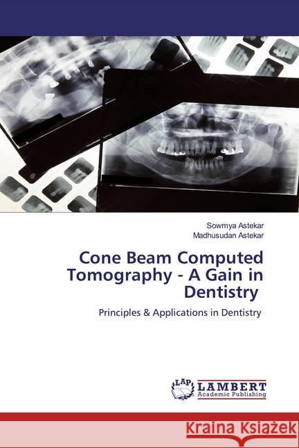 Cone Beam Computed Tomography - A Gain in Dentistry : Principles & Applications in Dentistry Astekar, Sowmya; Astekar, Madhusudan 9786200588012