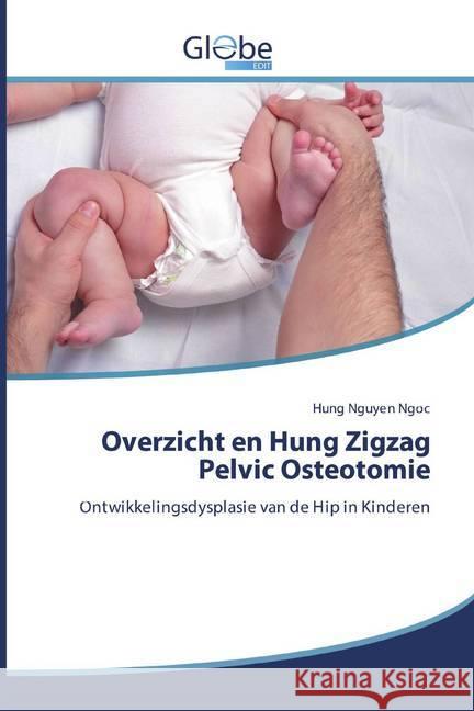 Overzicht en Hung Zigzag Pelvic Osteotomie : Ontwikkelingsdysplasie van de Hip in Kinderen Nguyen Ngoc, Hung 9786200599100