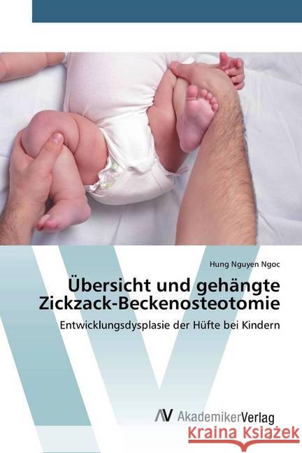 Übersicht und gehängte Zickzack-Beckenosteotomie : Entwicklungsdysplasie der Hüfte bei Kindern Nguyen Ngoc, Hung 9786200663511