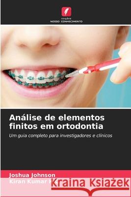 Análise de elementos finitos em ortodontia Johnson, Joshua, Kumar H C, Kiran 9786200690791 Edições Nosso Conhecimento