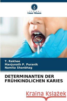 DETERMINANTEN DER FRÜHKINDLICHEN KARIES Rakhee, T., Puranik, Manjunath P., Shanbhag, Namita 9786200694577 Verlag Unser Wissen