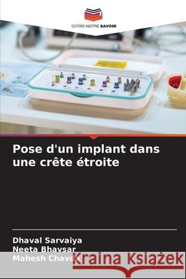 Pose d'un implant dans une crête étroite Sarvaiya, Dhaval, Bhavsar, Neeta, Chavda, Mahesh 9786200695284