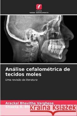 Análise cefalométrica de tecidos moles VARGHESE, ARACKAL BHAVITHA, R. Bhat, Shweta 9786200698056 Edições Nosso Conhecimento