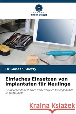 Einfaches Einsetzen von Implantaten für Neulinge Shetty, Dr Ganesh 9786200712677 Verlag Unser Wissen
