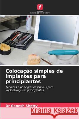 Colocação simples de implantes para principiantes Shetty, Dr Ganesh 9786200712929 Edições Nosso Conhecimento