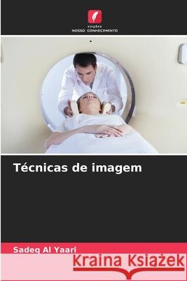 Técnicas de imagem Al Yaari, Sadeq 9786200714268