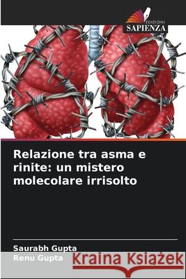 Relazione tra asma e rinite: un mistero molecolare irrisolto Gupta, Saurabh, Gupta, Renu 9786200741738