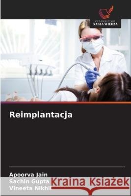 Reimplantacja Jain, Apoorva, Gupta, Sachin, Nikhil, Vineeta 9786200749239