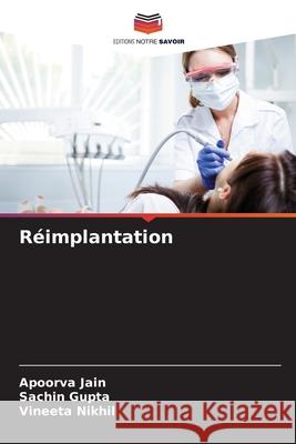 Réimplantation Jain, Apoorva, Gupta, Sachin, Nikhil, Vineeta 9786200749246