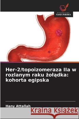 Her-2/topoizomeraza IIa w rozlanym raku zoladka: kohorta egipska Attallah, Hany 9786200773357