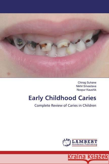 Early Childhood Caries : Complete Review of Caries in Children Suhane, Chirag; Srivastava, Nikhil; Kaushik, Noopur 9786200784278