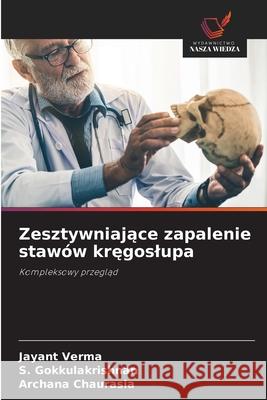 Zesztywniajace zapalenie stawów kregoslupa Verma, Jayant, Gokkulakrishnan, S., Chaurasia, Archana 9786200818683