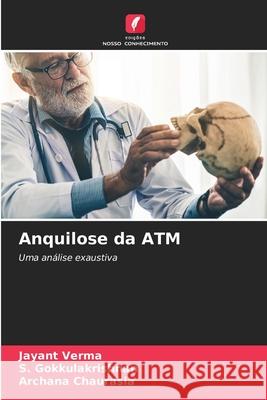 Anquilose da ATM Verma, Jayant, Gokkulakrishnan, S., Chaurasia, Archana 9786200818690