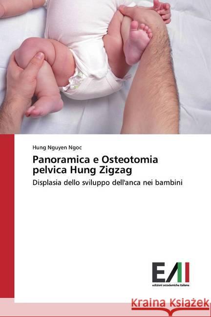 Panoramica e Osteotomia pelvica Hung Zigzag : Displasia dello sviluppo dell'anca nei bambini Nguyen Ngoc, Hung 9786200831194