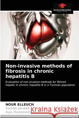 Non-invasive methods of fibrosis in chronic hepatitis B Nour Elleuch Sonda Jardak Aya Hammami 9786200871176