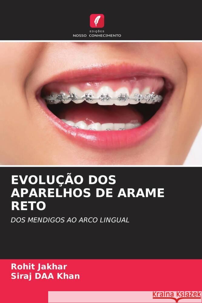 EVOLUÇÃO DOS APARELHOS DE ARAME RETO Jakhar, Rohit, khan, Siraj DAA 9786200894496 Edições Nosso Conhecimento